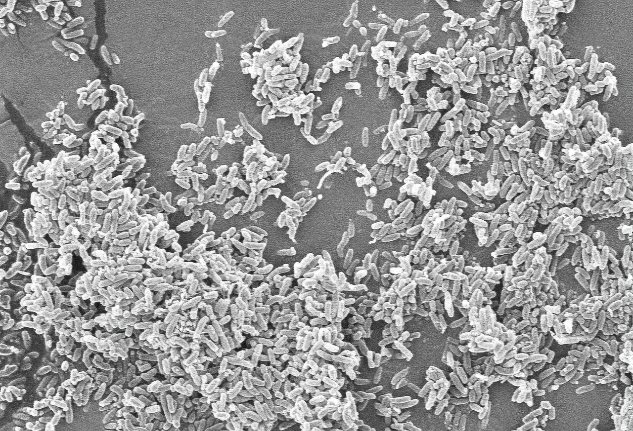 Scanning electron microscopy — image 2